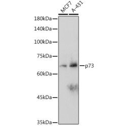 p73 Rabbit mAb