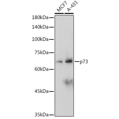 p73 Rabbit mAb