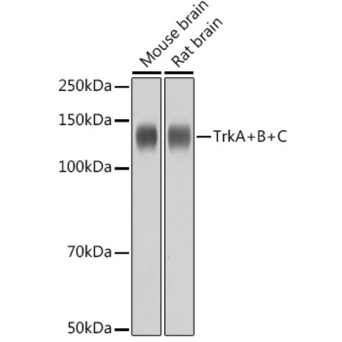TrkA+B+C Rabbit mAb