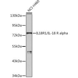 IL18R1/IL-18 R alpha Rabbit pAb