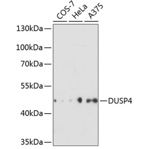 DUSP4 Rabbit pAb