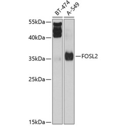 FOSL2 Rabbit pAb