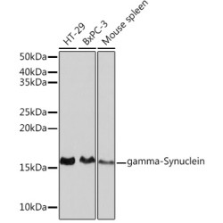 gamma-Synuclein Rabbit mAb