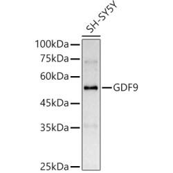 GDF9 Rabbit pAb