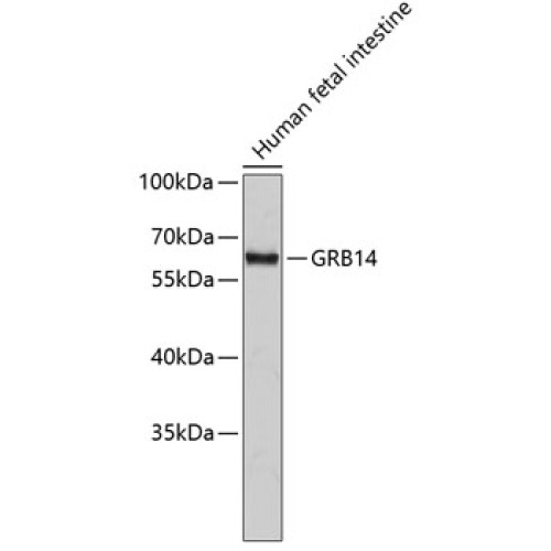 GRB14 Rabbit pAb