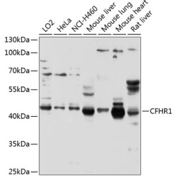 CFHR1 Rabbit pAb