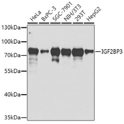 IGF2BP3 Rabbit pAb