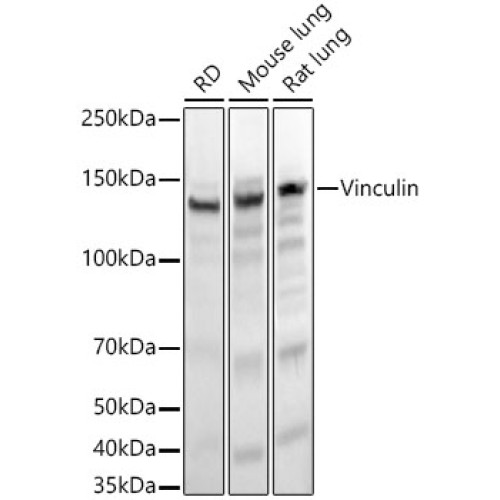 Vinculin Rabbit mAb