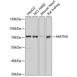 MATN4 Rabbit pAb
