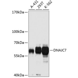 DNAJC7 Rabbit pAb