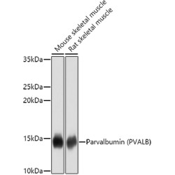 Parvalbumin/PVALB Rabbit pAb