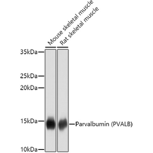 Parvalbumin/PVALB Rabbit pAb