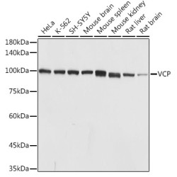 VCP Rabbit pAb