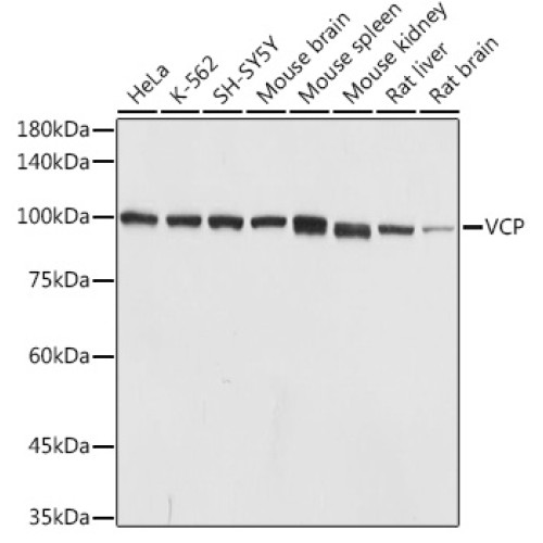 VCP Rabbit pAb