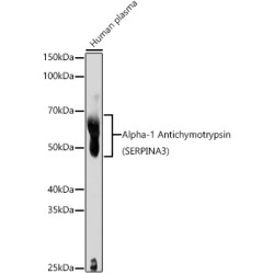 Alpha-1 Antichymotrypsin (SERPINA3) Rabbit pAb