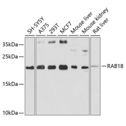 RAB18 Rabbit pAb