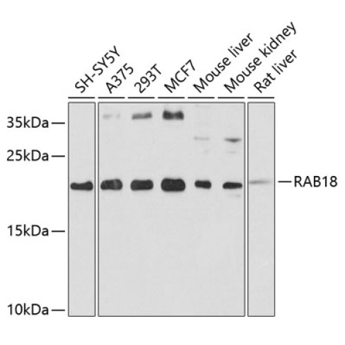 RAB18 Rabbit pAb