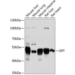 GPT Rabbit pAb