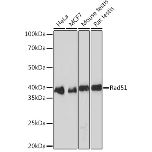 Rad51 Rabbit mAb