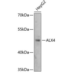 ALX4 Rabbit pAb