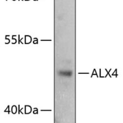ALX4 Rabbit pAb