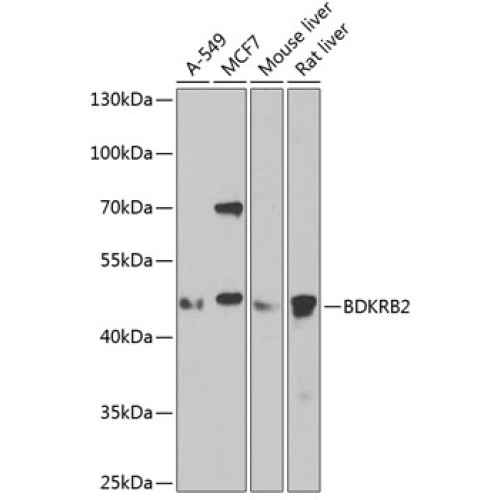 BDKRB2 Rabbit pAb