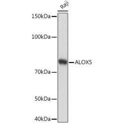 ALOX5 Rabbit mAb