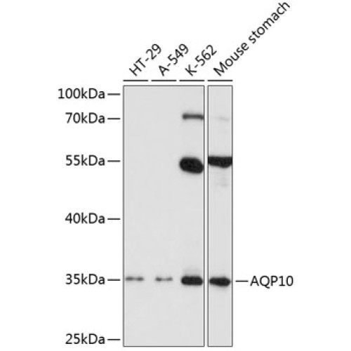 AQP10 Rabbit pAb