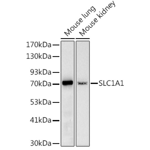 SLC1A1 Rabbit pAb