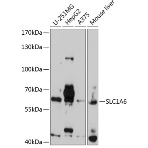 SLC1A6 Rabbit pAb