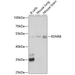EDNRB Rabbit pAb