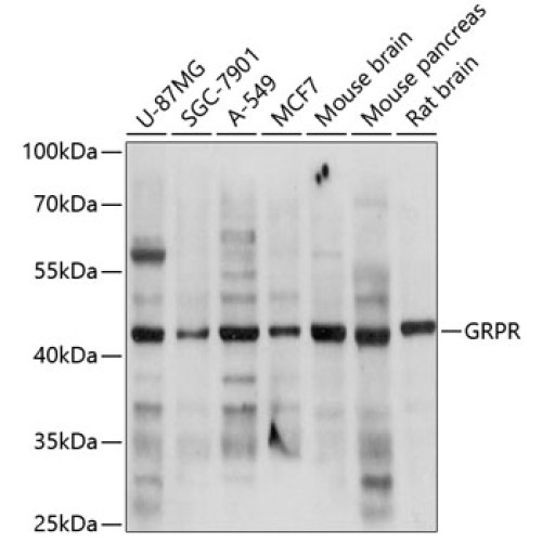 GRPR Rabbit pAb