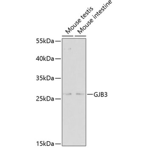 GJB3 Rabbit pAb