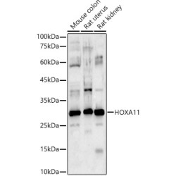 HOXA11 Rabbit pAb