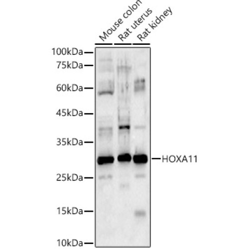 HOXA11 Rabbit pAb