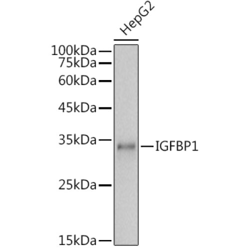 IGFBP1 Rabbit pAb