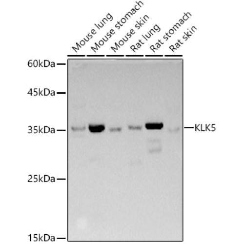 KLK5 Rabbit pAb