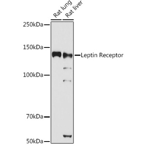 Leptin Receptor Rabbit pAb