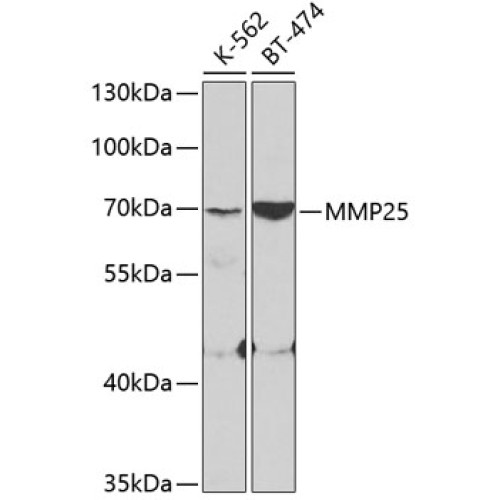 MMP25 Rabbit pAb