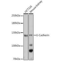 E-Cadherin Rabbit pAb