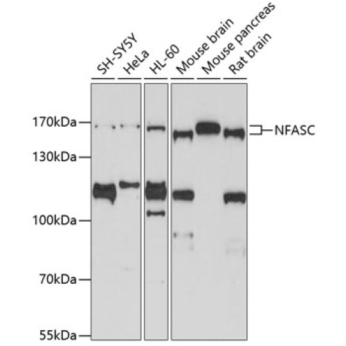 NFASC Rabbit pAb