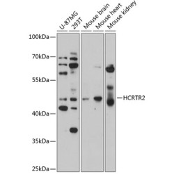 HCRTR2 Rabbit pAb