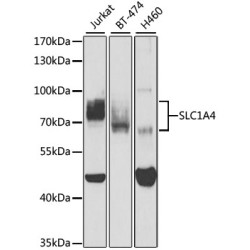 SLC1A4 Rabbit pAb