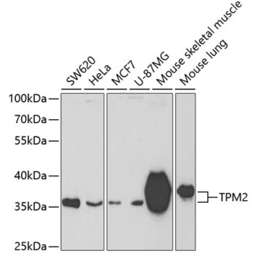 TPM2 Rabbit pAb