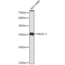NKX2-1 Rabbit pAb