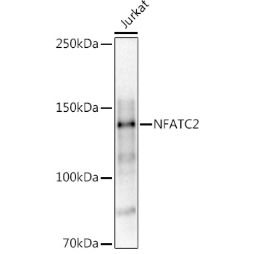 NFATC2 Rabbit pAb
