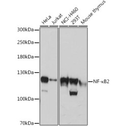 NF-κB2 Rabbit pAb