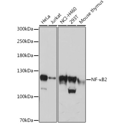 NF-κB2 Rabbit pAb