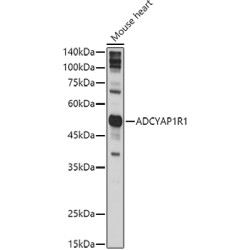 ADCYAP1R1 Rabbit pAb