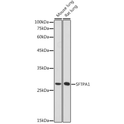 SFTPA1 Rabbit pAb